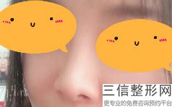 东莞隆鼻整形医院排名前六！ 东莞华美医疗美容医院口碑良好