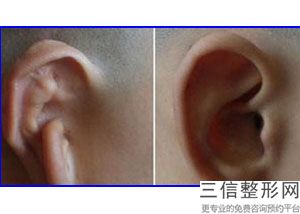 东莞十大自体耳软骨隆鼻整形医院排名榜！东莞天姬医疗美容机构实力上榜