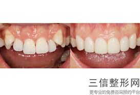 佛山口腔医院排名前六！佛山顺德德伦口腔医院口碑良好