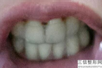 福州正规口腔医院有哪些！首次上榜