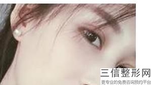 贵阳双眼皮医院排名前十！贵阳华美紫馨整形美容医院锁定前十