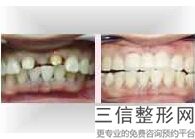 国内做牙齿整形技术好的医院排行榜！遥遥领先