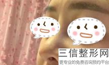 哈尔滨鼻部整形医院排名前十！哈尔滨菲思医疗美容医院不容错过
