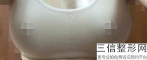 哈尔滨隆胸医院排名前十不踩雷！哈尔滨医科大学附属第二医院整形科位列前十