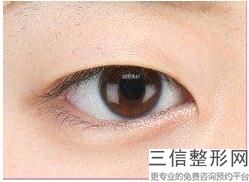 哈尔滨去眼袋整形医院排名前八！哈尔滨成美医疗美容门诊部遥遥领先