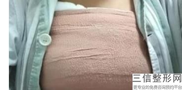 杭州比较好的隆胸整形机构排名！杭州艺星医疗美容医院实力上榜