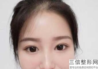 杭州激光近视眼哪家好!杭州西湖朝聚眼科医院实力入围