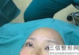 杭州有效祛眼袋整形医院排名榜前五推荐！口碑不错