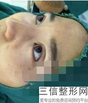河南整形医院排名榜前十评点！郑州美眼整形医院口碑良好