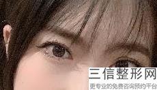 衡阳做双眼皮整形医院哪家好！实力入围