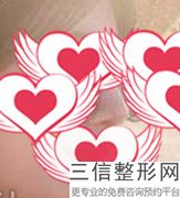 吉林市隆鼻哪家医院好！吉林林燕整形医疗美容诊所遥遥领先