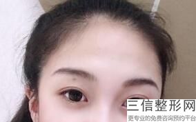 江苏省近视眼手术医院排名！南京大学医学院附属金陵医院眼科实力超强