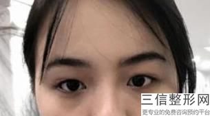 江苏省近视眼手术医院排名！南京大学医学院附属金陵医院眼科实力超强