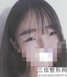 江苏省近视眼手术医院排名！南京大学医学院附属金陵医院眼科实力超强