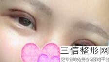 江苏省近视眼手术医院排名！南京大学医学院附属金陵医院眼科实力超强
