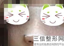 江西鼻部整形较新正规医院排名！实力非凡