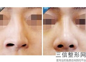 江西鼻部整形较新正规医院排名！实力非凡