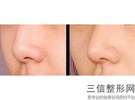 江西鼻部整形较新正规医院排名！实力非凡