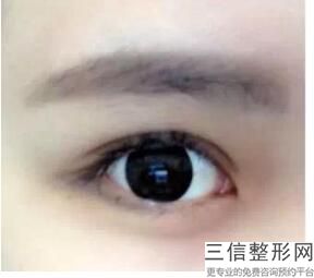 金华比较好的去眼袋整形机构前五！金华亚美整形美容门诊部成立于2017年