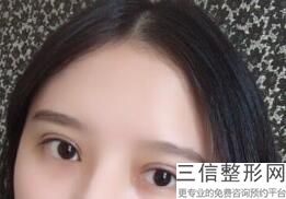 近视手术眼科医院排名！口碑不错