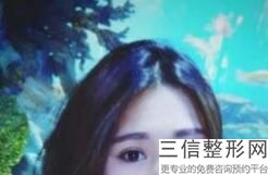 昆明割双眼皮医院排名前十！云南铜雀台美容医院位列前十