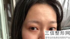 昆明割双眼皮医院排名前十！云南铜雀台美容医院位列前十