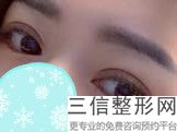 昆明眼袋整形医院排名前十！昆明坤钰医疗美容门诊部实力超强