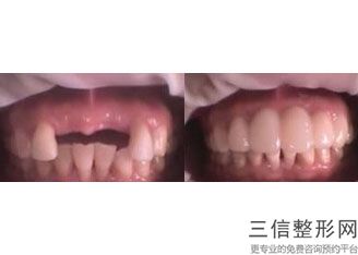 连云港口腔医院排行榜前五强新鲜出炉啦！连云港中新口腔排名靠前