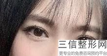 临汾双眼皮医生排名前十选前九！高一娜实力超强