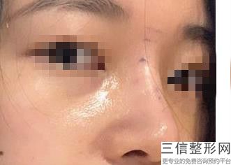 南京排名前10名隆鼻医生！姚刚医生实力上榜