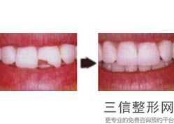 南京市种植牙医院排名榜！遥遥领先