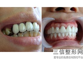 南宁技术较好的三甲口腔医院排名前五！南宁市第一医院口腔科口腔优选