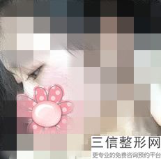 青岛去眼袋整形医院排名前八!实力非凡
