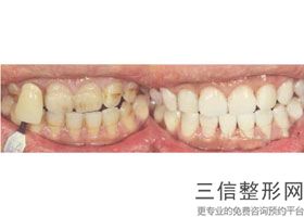 全国口腔医院排行榜前十细数!四川华西口腔医院口碑不错