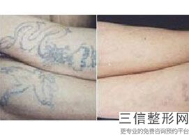 全国微整形和整形医院排名前十！北京军区总医院皮肤激光美容整形中心锁定前十