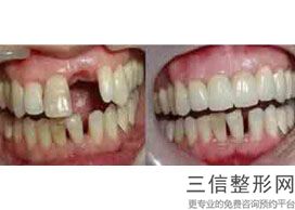 泉州整牙比较好的医院有哪些!泉州牙博士口腔实力超强