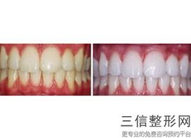 厦门公立口腔医院排行榜前四名单公开！厦门市第二医院口腔科遥遥领先