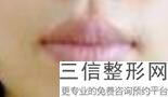 上海唇部整形医院排名前十！上海伊莱美医疗美容医院不容错过