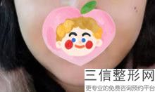 上海唇部整形医院排名前十！上海伊莱美医疗美容医院不容错过