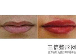 上海唇部整形医院排名前十！上海伊莱美医疗美容医院不容错过