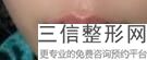 上海唇部整形医院排名前十！上海伊莱美医疗美容医院不容错过