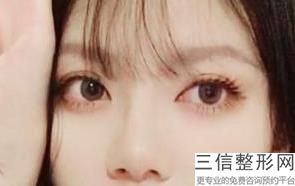 上海哪家整形医院双眼皮做的好！实力入围