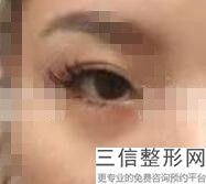 上海去眼袋整形医院排名前十！上海华美医疗美容医院不容错过