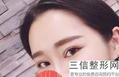 上海双眼皮医生排名前十！明慧医生实力上榜