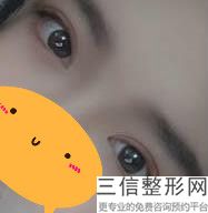 上海双眼皮医生排名前十！明慧医生实力上榜