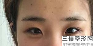 上海双眼皮整形医院排名前十,上海丽质医疗美容门诊部口碑不错