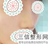 深圳隆鼻医院排行前十！深圳北大医院整形科排名靠前