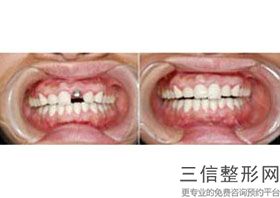 深圳市口腔医院排名榜前五新版发布！深圳登特口腔门诊部位列前十