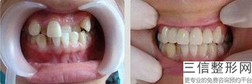 深圳私人口腔医院十大排名榜！中山大学附属第八医院抄口腔科实力非凡