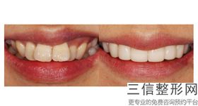 深圳私人口腔医院十大排名榜！中山大学附属第八医院抄口腔科实力非凡
